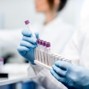 Ministerstvo zdravotnictví spouští plošný screening pozitivních vzorků na přítomnost mutací koronaviru