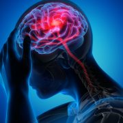 Ministerstvo zdravotnictví a odborné společnosti připravily metodiku pro péči o pacienty s akutní cévní mozkovou příhodou