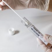 Epidemiologicky významné kontakty v rámci jedné domácnosti budou nově indikovány k PCR testu